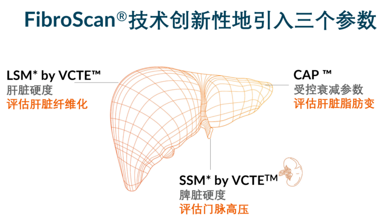 喜訊！FDA擴大了FibroScan?在肝臟綜合管理中的應用范圍